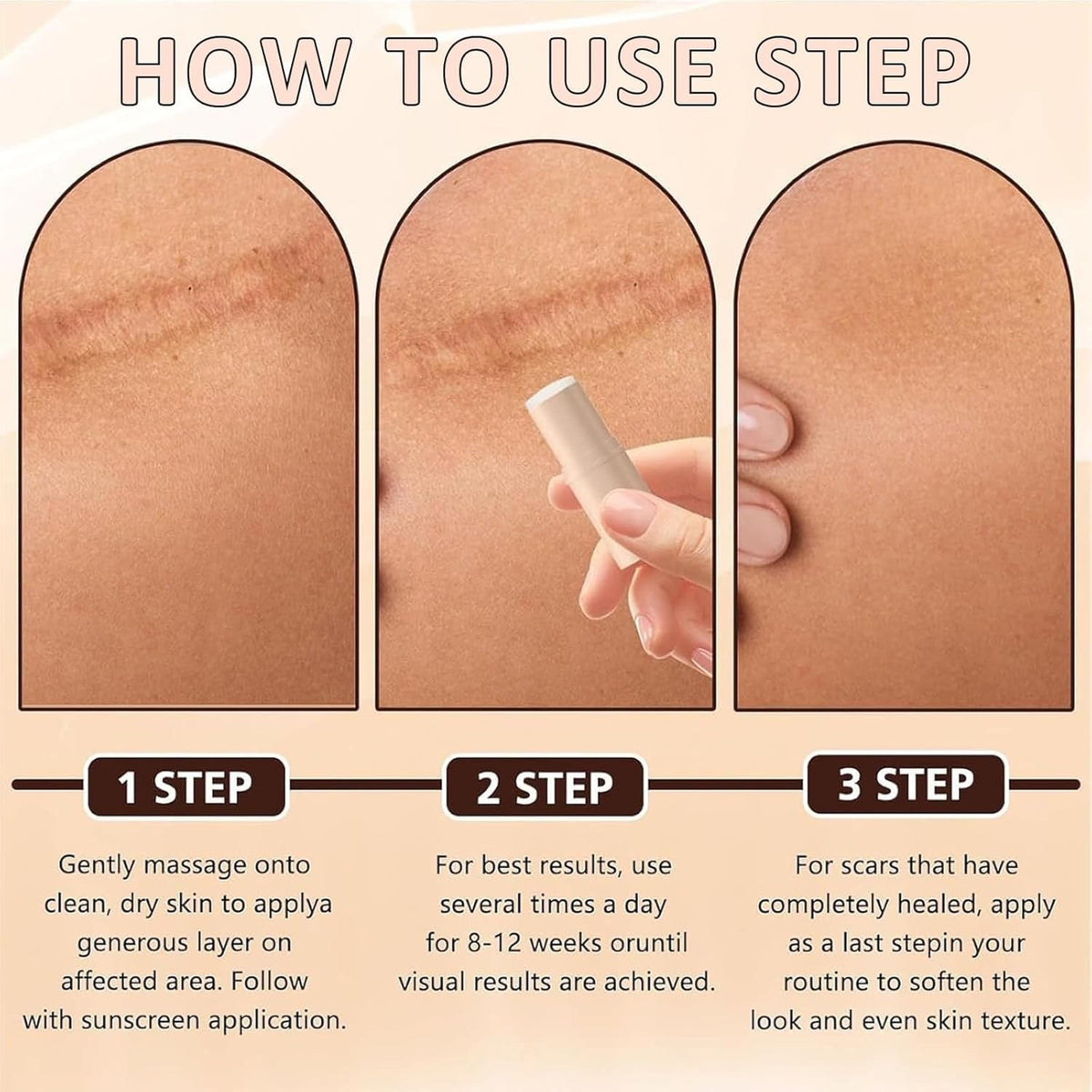 Silicone Scar Stick, Silicone Stick for Face and Body, Help to Improve the Appearance of Scars, For Use After Surgery, Acne, Burns, Cuts, Lightweight Easy to Use (1Pc)